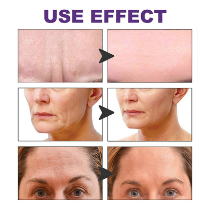 100pcs Face Forehead Cheek Chin Sticker Anti-Wrinkles Skin Lifting V Shape Anti-Aging Strip Makeup Face Eye Patches Beauty Tools